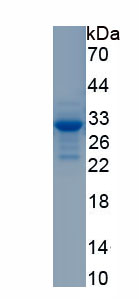 Active Cluster Of Differentiation 320 (C<b>D320</b>)