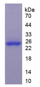 Active Glutathione S Transferase Pi (GSTp)