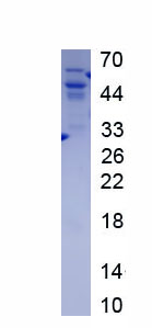 Active Cluster Of Differentiation 4 (CD4)