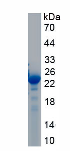 Active Granzyme K (GZMK)