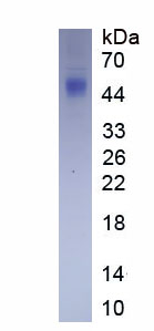 Active Cluster Of Differentiation 56 (CD56)