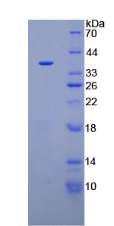 Active Plasminogen (Plg)