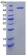 Active V-Myc Myelocytomatosis Viral Oncogene Homolog (MYC)