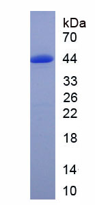 Active Complement Component 8b (C8b)