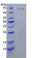 Active Perforin 1 (PRF1)