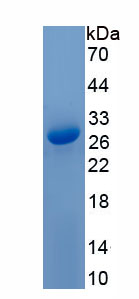 Active Ornithine Decarboxylase (ODC)