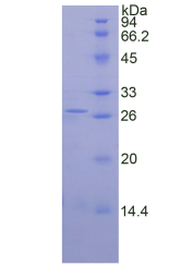 Active Ornithine Decarboxylase (ODC)