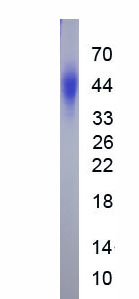 Active Cluster Of Differentiation 74 (CD74)