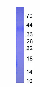 Active Immunoglobulin Associated Alpha (Iga)