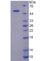 Active Lipopolysaccharide Binding Protein (LBP)