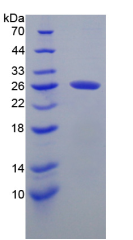 Active Chitinase-3-like Protein 1 (CHI3L1)