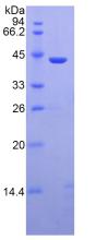 Active Mannose Binding Lectin (MBL)