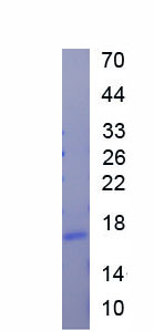 Active Mannose Binding Lectin (MBL)