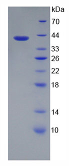 Active Interleukin 3 Receptor Alpha (IL3Ra)