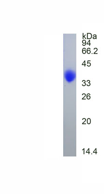 Active Cluster Of Differentiation 2 (CD2)