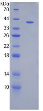 Active Chemokine (C-X-C Motif) Ligand 2 (CXCL2)