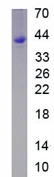 Active Thymosin Beta 4 (TMSB4X)