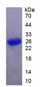 Active Suppressors Of Cytokine Signaling 3 (SOCS3)