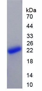 Active B-Cell Activating Factor (BAFF)