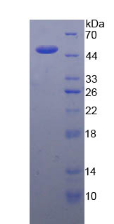 Active Interleukin 21 (IL21)