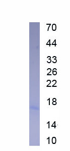 Active Interleukin 21 (IL21)