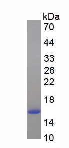 Active Fatty Acid Binding Protein 4 (FABP4)