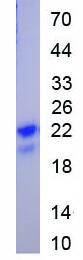 Active Vascular Endothelial Growth Factor 165 (VEGF165)