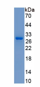 Active Transglutaminase 3, Epidermal (TGM3)