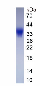 Active Cluster Of Differentiation 7 (CD7)