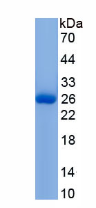 Active Vitamin D Binding Protein (DBP)