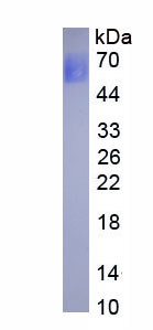 Active Interleukin 6 Receptor (IL6R)