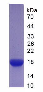 Active Interleukin 6 Receptor (IL6R)