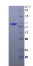 Active Tubulin Beta (TUBb)