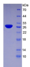 Active Tissue Factor Pathway Inhibitor 2 (TFPI2)