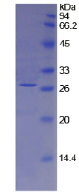 Active Tissue Factor Pathway Inhibitor 2 (TFPI2)