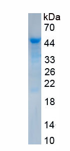 Active Immunoglobulin D (IgD)
