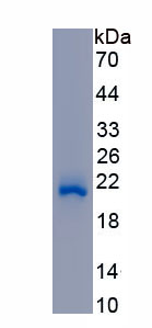 Active Protein S (PROS)