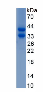 Active Hepcidin (Hepc)