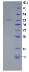 Active Receptor Activator Of Nuclear Factor Kappa B (RANk)