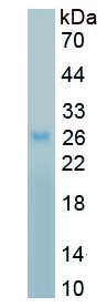 Active Mothers Against Decapentaplegic Homolog 2 (Smad2)
