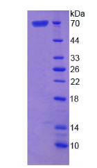 Active Asporin (ASPN)