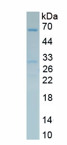 Active Carboxylesterase 1 (CES1)