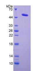 Active Lysyl Oxidase (LOX)