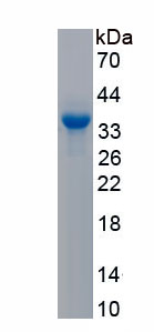 Active Valosin Containing Protein (VCP)