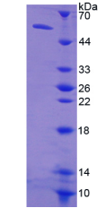 Active Thymidine Kinase 1, Soluble (TK1)