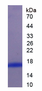 Active Fibroblast Growth Factor 21 (FGF21)