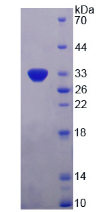 Active Platelet Derived Growth Factor Subunit B (PDGFB)