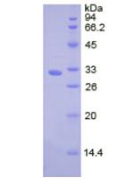 Active Cathepsin V (CTSV)