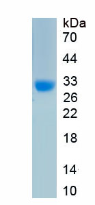 Active Carbonic Anhydrase III, Muscle Specific (CA3)