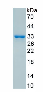 Active Carbonic Anhydrase IV (CA4)